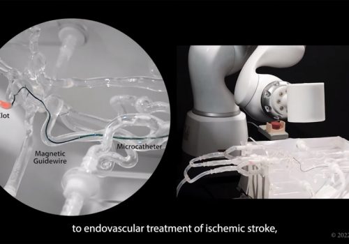 एमआईटी इन्जिनीयरहरुद्वारा इमर्जेन्सी स्ट्रोक सर्जरीमा सघाउने रोबोटिक पाखुरा निर्माण